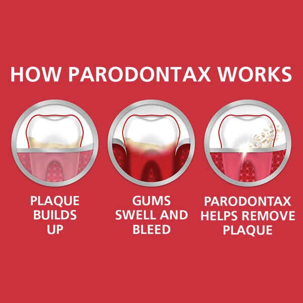 Paradontax Daily Fluoride Anticavity and Antigingivitis Toothpaste to Help Prevent Bleeding Gums