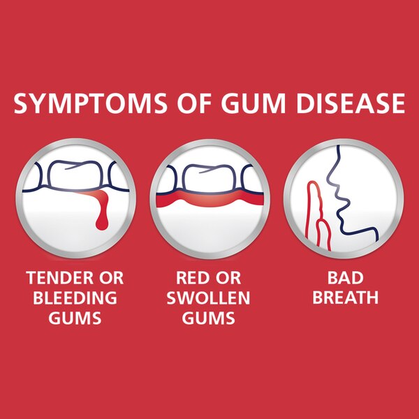 Paradontax Daily Fluoride Anticavity and Antigingivitis Toothpaste to Help Prevent Bleeding Gums
