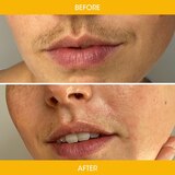 Nad's Natural Facial Strips, thumbnail image