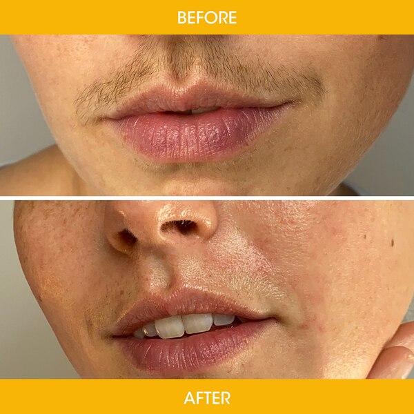 Nad's Natural Facial Strips