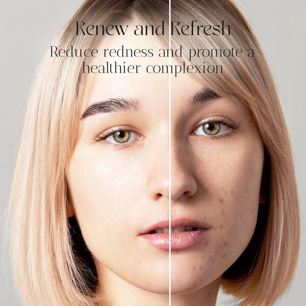 Skin Centrick Acne Toner, 3.38 OZ
