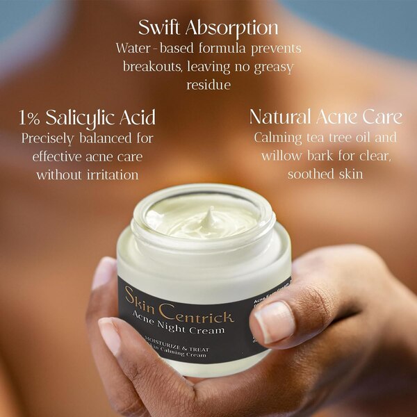 Skin Centrick Acne Night Cream, 1.69 OZ