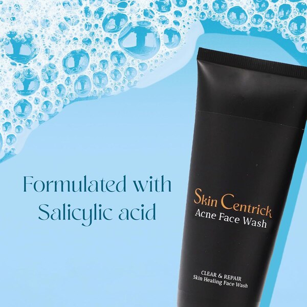 Skin Centrick Acne Face Wash, 3.38 OZ