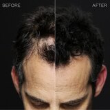 Toppik Hair Building Fibers, thumbnail image