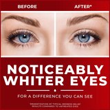 Clear Eyes Maximum Redness Relief Eye Drops, thumbnail image