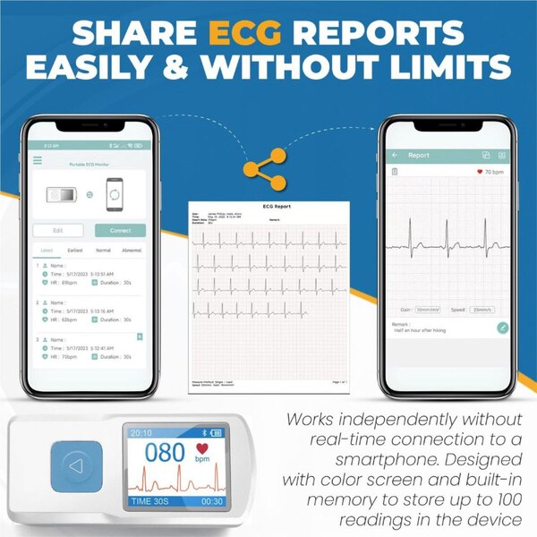 Blue Echo Care Portable ECG Monitor