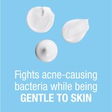 Neutrogena On-The-Spot Acne Treatment, 2.5% Benzoyl Peroxide, 0.75 OZ, thumbnail image