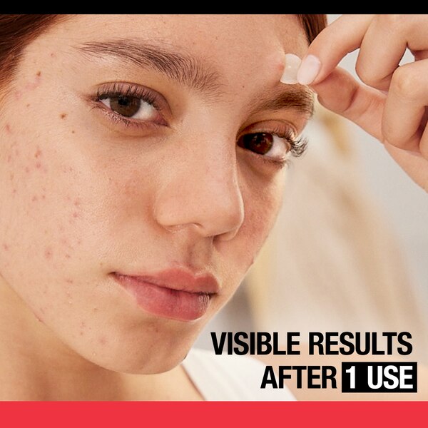 Neutrogena Stubborn Acne Hydrocolloid Blemish Patches,