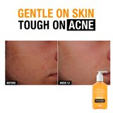 Neutrogena Oil-Free Salicylic Acid Acne Fighting Face Wash For Sensitive Skin, Fragrance-Free, 9.1 OZ, thumbnail image