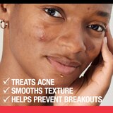 Neutrogena Stubborn Texture Acne Cleanser with Salicylic Acid, thumbnail image