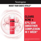Neutrogena Stubborn Texture Acne Cleanser with Salicylic Acid, thumbnail image
