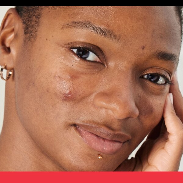 Neutrogena Stubborn Texture Acne Cleanser with Salicylic Acid