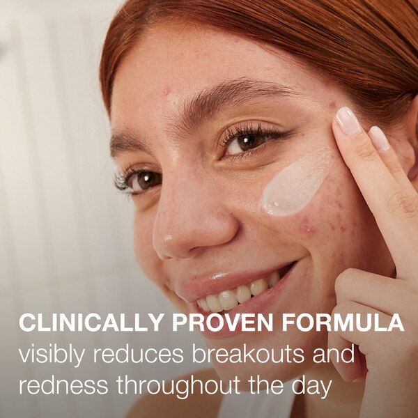 Neutrogena Stubborn Acne AM Treatment with Benzoyl Peroxide, 2 OZ