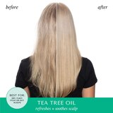 Hask Tea Tree Scalp Serum, 3.3 OZ, thumbnail image