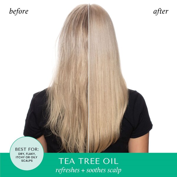 Hask Tea Tree Scalp Serum, 3.3 OZ