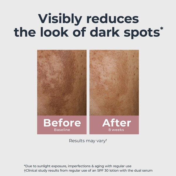 Eucerin Radiant Tone Dark Spot Corrector Serum