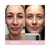 Revive Collagen Premium Liquid Marine Collagen Supplement Sachets, 14 CT, thumbnail image