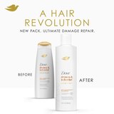 Dove Dermacare Scalp Anti-Dandruff Shampoo, 12 OZ, thumbnail image