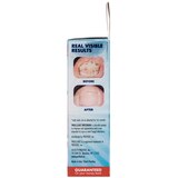 ProClearz Britenow Nail Rejuvenator, thumbnail image