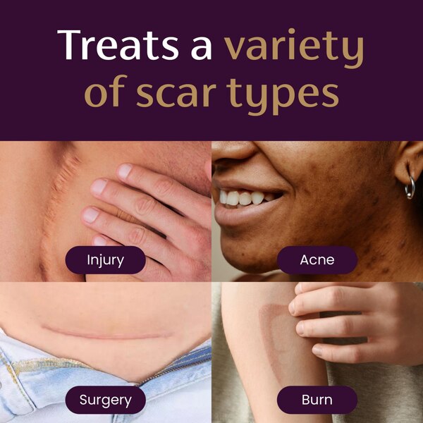 Mederma Advanced Scar Gel