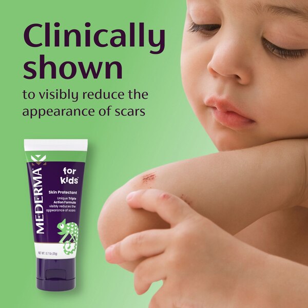 Mederma for Kids
