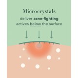 Rael Beauty Miracle Patch Microcrystal Spot Cover, thumbnail image