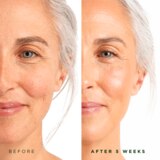 Tree of Life Retinol Serum, 2 OZ, thumbnail image