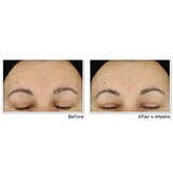 RoC Retinol Correxion Line Smoothing Night Serum Capsules, thumbnail image