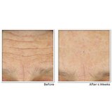 RoC Multi Correxion Crepe Repair Face & Neck Cream, 1.7 OZ, thumbnail image