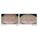 RoC Multi Correxion Hydrate + Plump SPF 30 Daily Moisturizer with Hyaluronic Acid, 1.7 OZ, thumbnail image