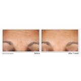 RoC Multi Correxion Hydrate + Plump Eye Cream with Hyaluronic Acid, 0.5 OZ, thumbnail image