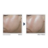 RoC Derm Correxion Contour Cream, 1.7 OZ, thumbnail image