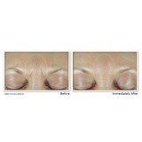 RoC Derm Correxion Fill + Treat Serum, 0.5 OZ, thumbnail image