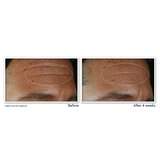 RoC Derm Correxion Fill + Treat Serum, 0.5 OZ, thumbnail image 5 of 7