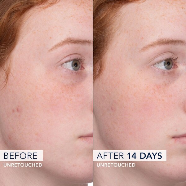 ROC Barrier Renew PM Moisturizer
