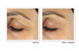 RoC Retinol Correxion Anti-Aging Eye Cream Treatment, 0.5 OZ, thumbnail image 3 of 6