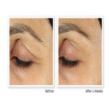 RoC Retinol Correxion Anti-Aging Eye Cream Treatment, 0.5 OZ, thumbnail image