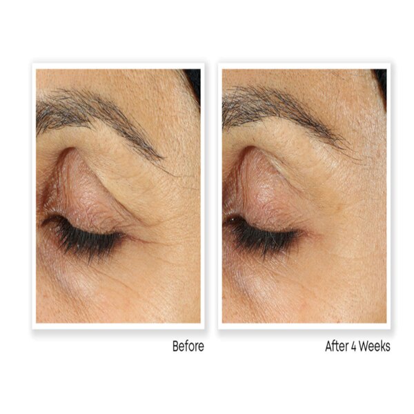 RoC Retinol Correxion - Crema de tratamiento antienvejecimiento para ojos, 0.5 oz