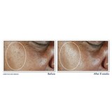RoC Multi Correxion 5 In 1 Anti-Aging Face Moisturizer, 1.7 OZ, thumbnail image