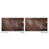 RoC Multi Correxion 5 in 1 Anti-Aging Facial Night Cream, 1.7 OZ, thumbnail image