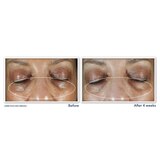 RoC Multi Correxion 5 in 1 Eye Cream, Anti-Aging Treatment, .5 OZ, thumbnail image