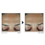 RoC Retinol Correxion Deep Wrinkle Anti-Aging Filler, 1 OZ, thumbnail image