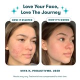 ProactivMD 3-Step Acne Routine with Adapalene Gel 0.1%, thumbnail image