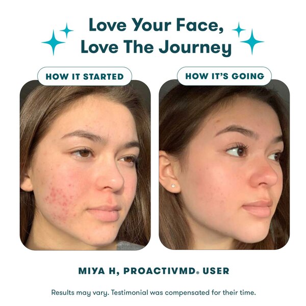 ProactivMD 3-Step Acne Routine with Adapalene Gel 0.1%