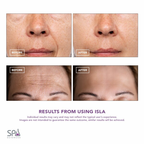 Spa Sciences ISLA Sonic Face & Body Contouring System