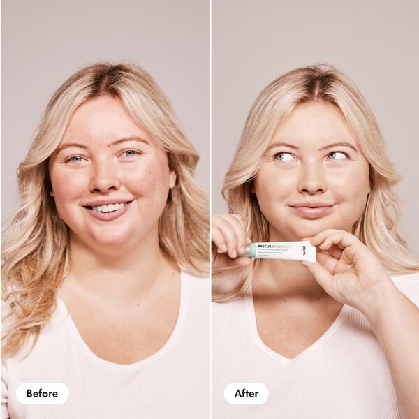 Hero Cosmetics Rescue Balm +Red Correct