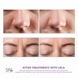 Spa Sciences LELA Skin Spatula, thumbnail image