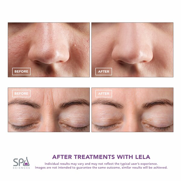 Spa Sciences LELA Skin Spatula