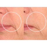 SiO Super LipLift Patch, 1 CT, thumbnail image