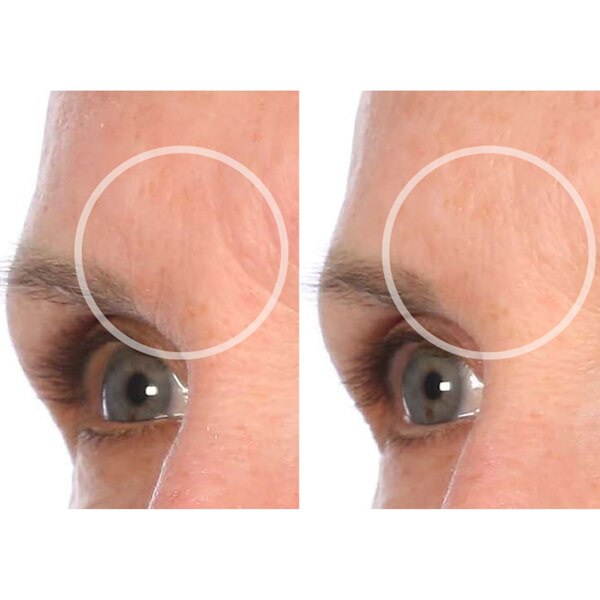 SiO SuperLift Wrinkle Smoothing Pack, 4 CT